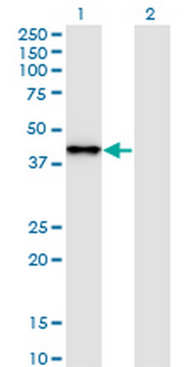 SNAPC2 Antibody in Western Blot (WB)