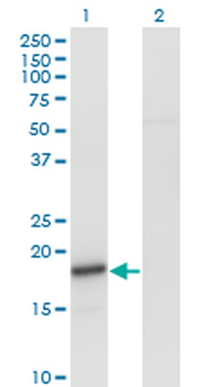 SNCA Antibody in Western Blot (WB)