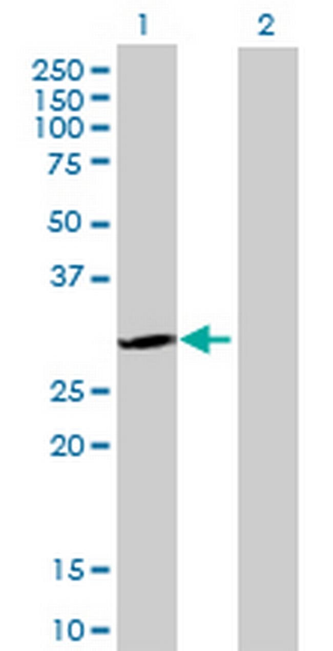 SNRPA Antibody in Western Blot (WB)