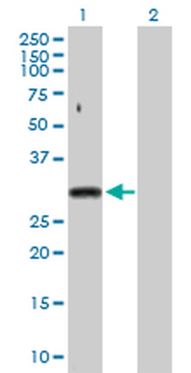 SNRPA Antibody in Western Blot (WB)