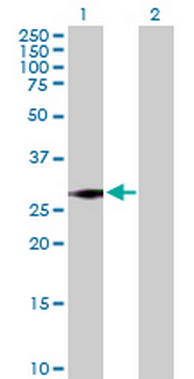 SNRPN Antibody in Western Blot (WB)