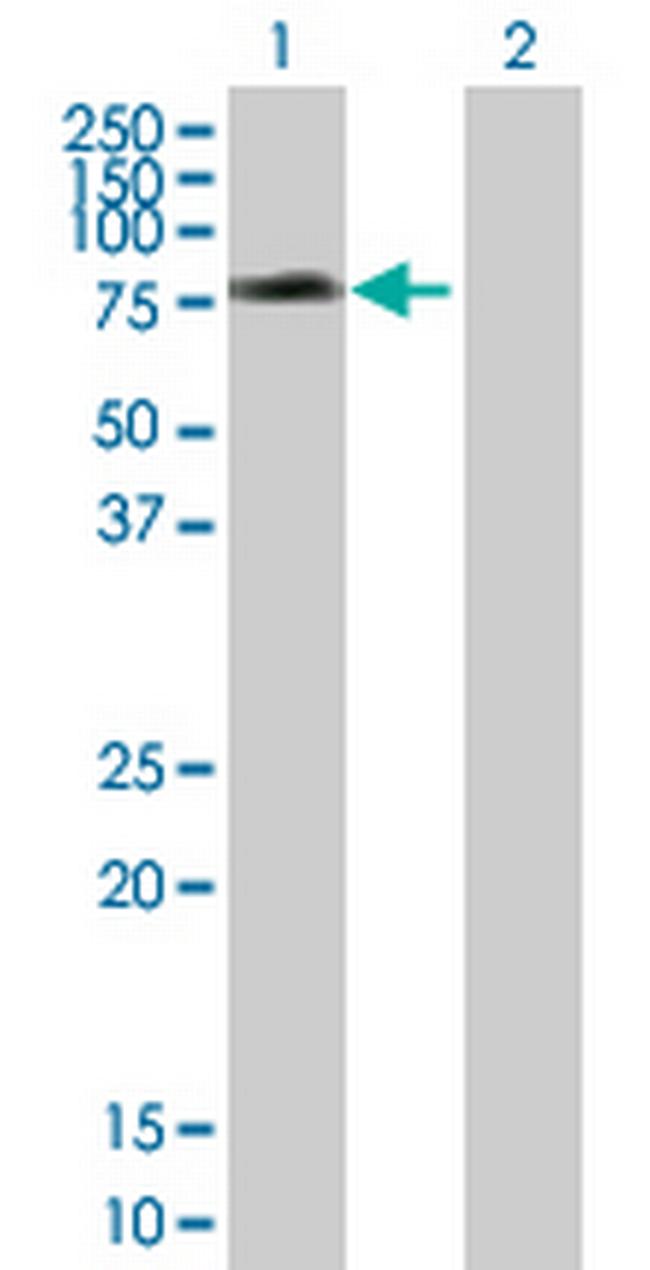 SNX1 Antibody in Western Blot (WB)