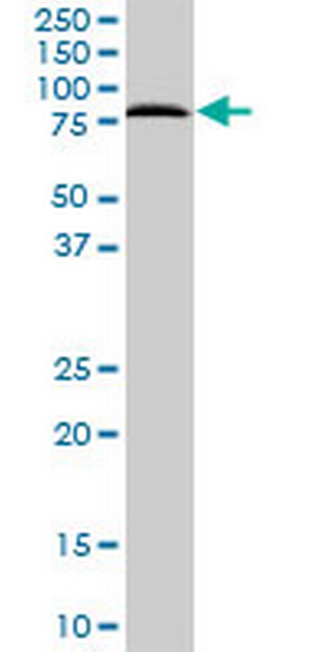 SNX1 Antibody in Western Blot (WB)