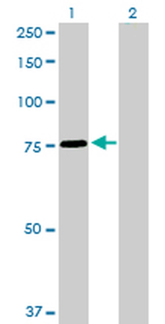 SNX1 Antibody in Western Blot (WB)