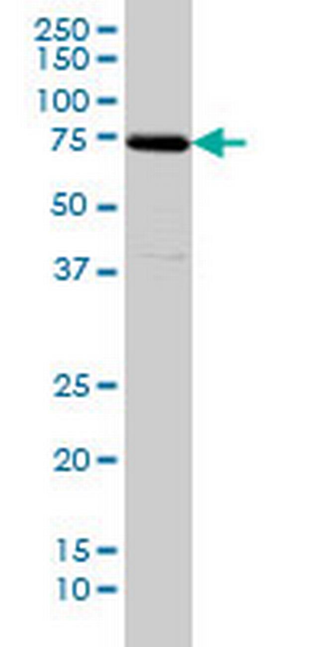 SNX1 Antibody in Western Blot (WB)