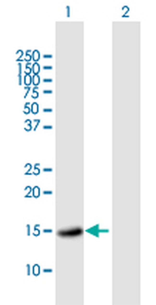SOD2 Antibody in Western Blot (WB)