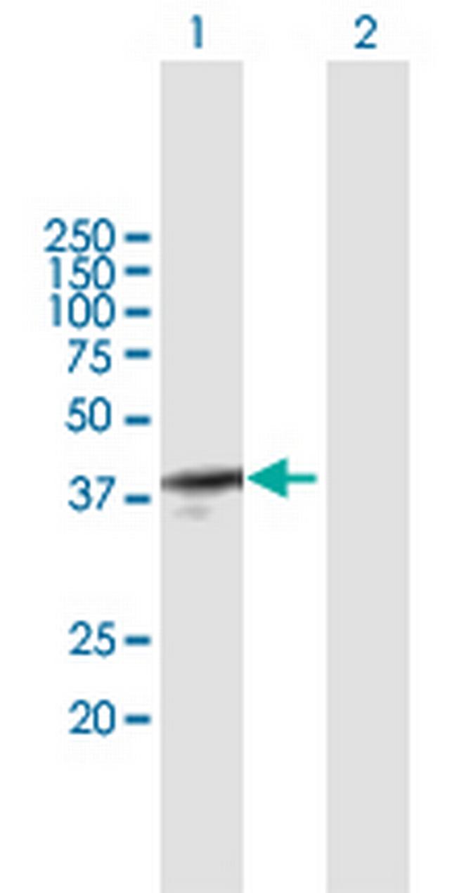 SOX12 Antibody in Western Blot (WB)