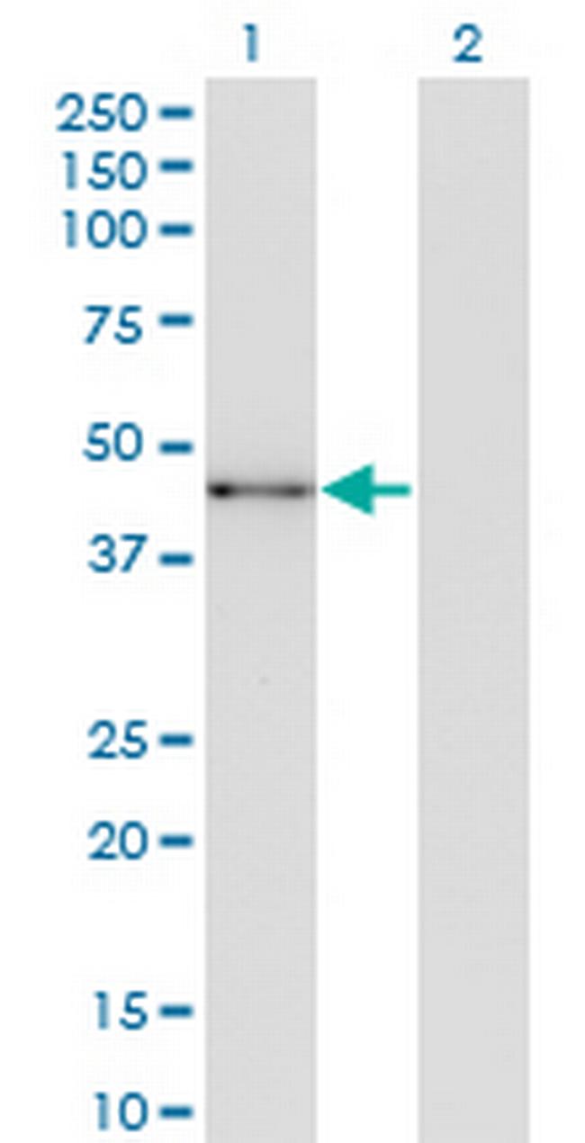 SOX12 Antibody in Western Blot (WB)