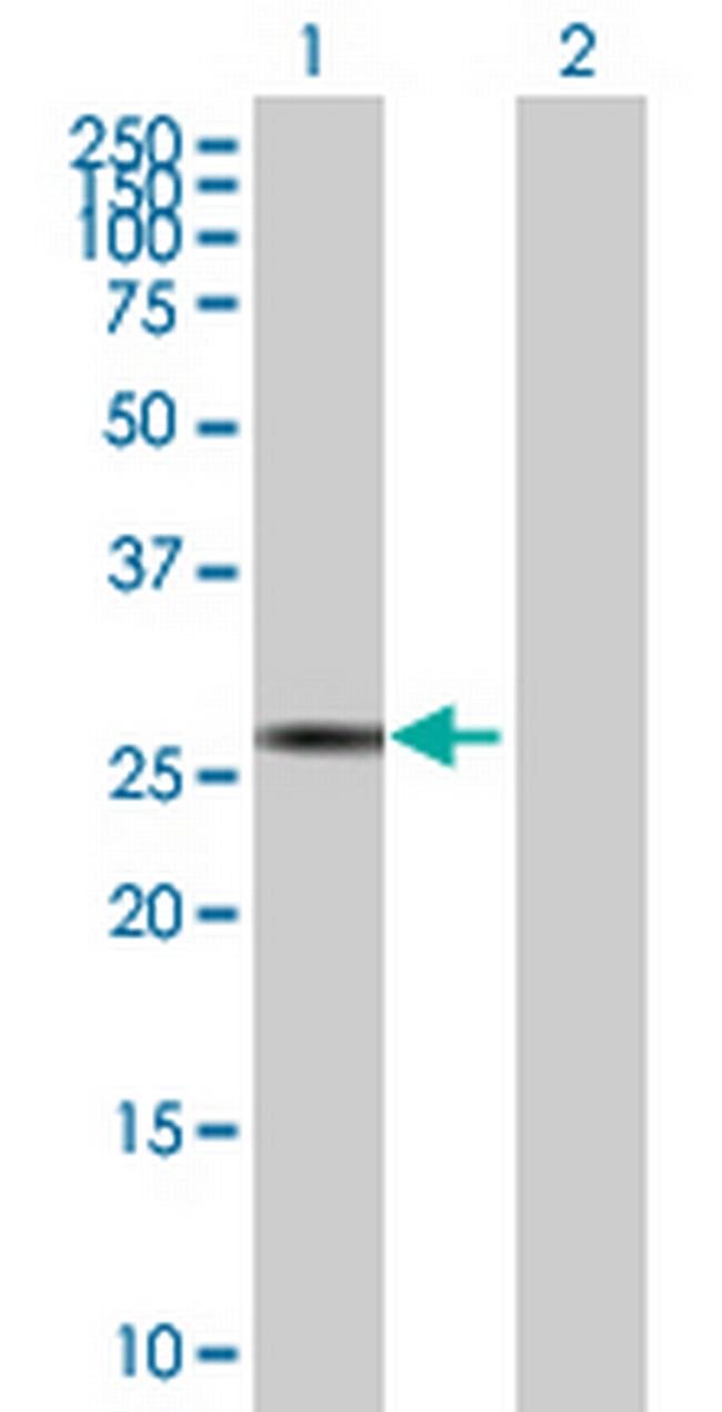 SP2 Antibody in Western Blot (WB)