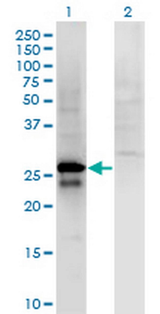 SP2 Antibody in Western Blot (WB)