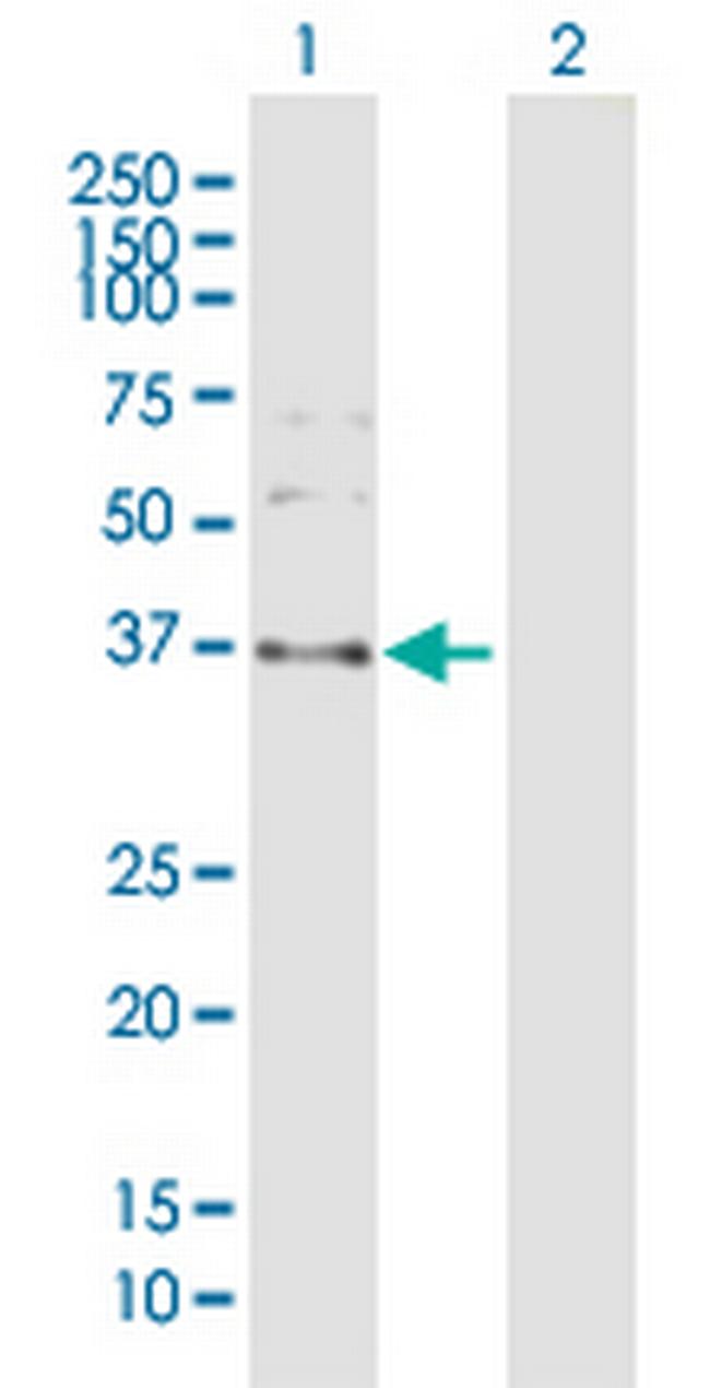 SPARC Antibody in Western Blot (WB)