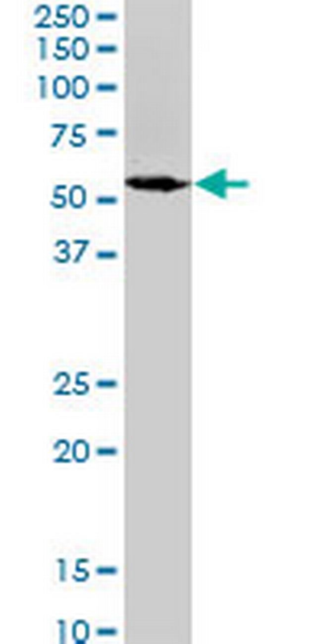 SPAST Antibody in Western Blot (WB)