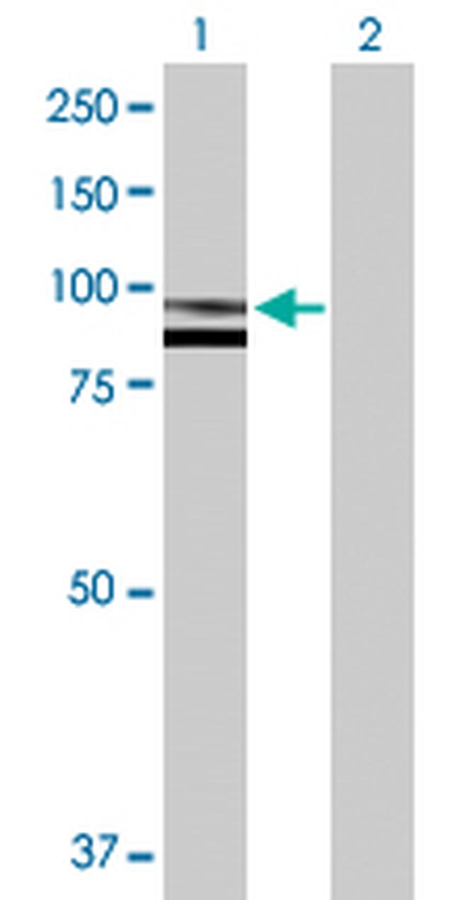 SPG7 Antibody in Western Blot (WB)