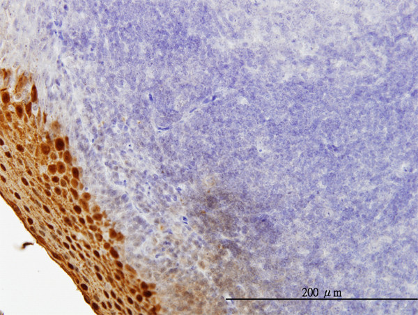 SPRR3 Antibody in Immunohistochemistry (Paraffin) (IHC (P))