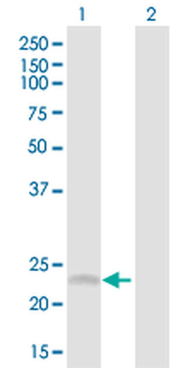 SRD5A1 Antibody in Western Blot (WB)