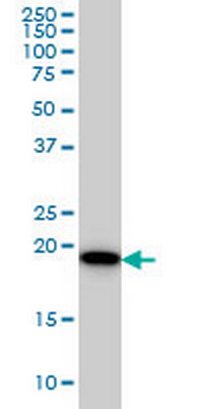 SRI Antibody in Western Blot (WB)