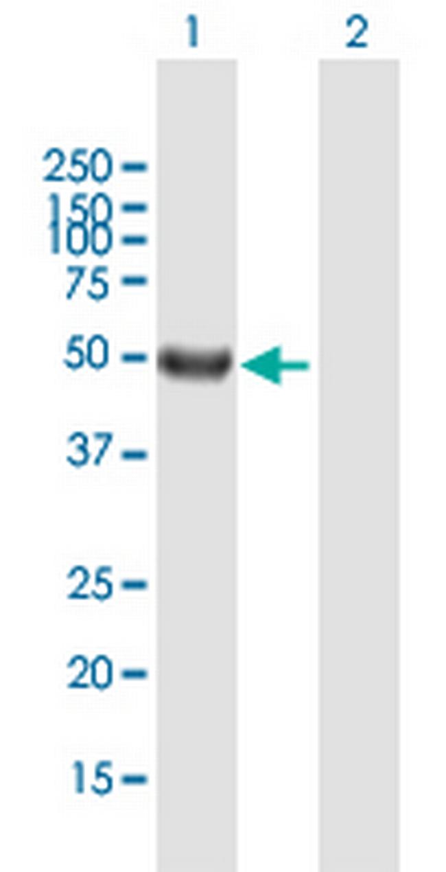 SRMS Antibody in Western Blot (WB)