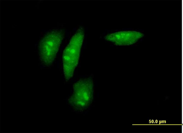 SRPK2 Antibody in Immunocytochemistry (ICC/IF)