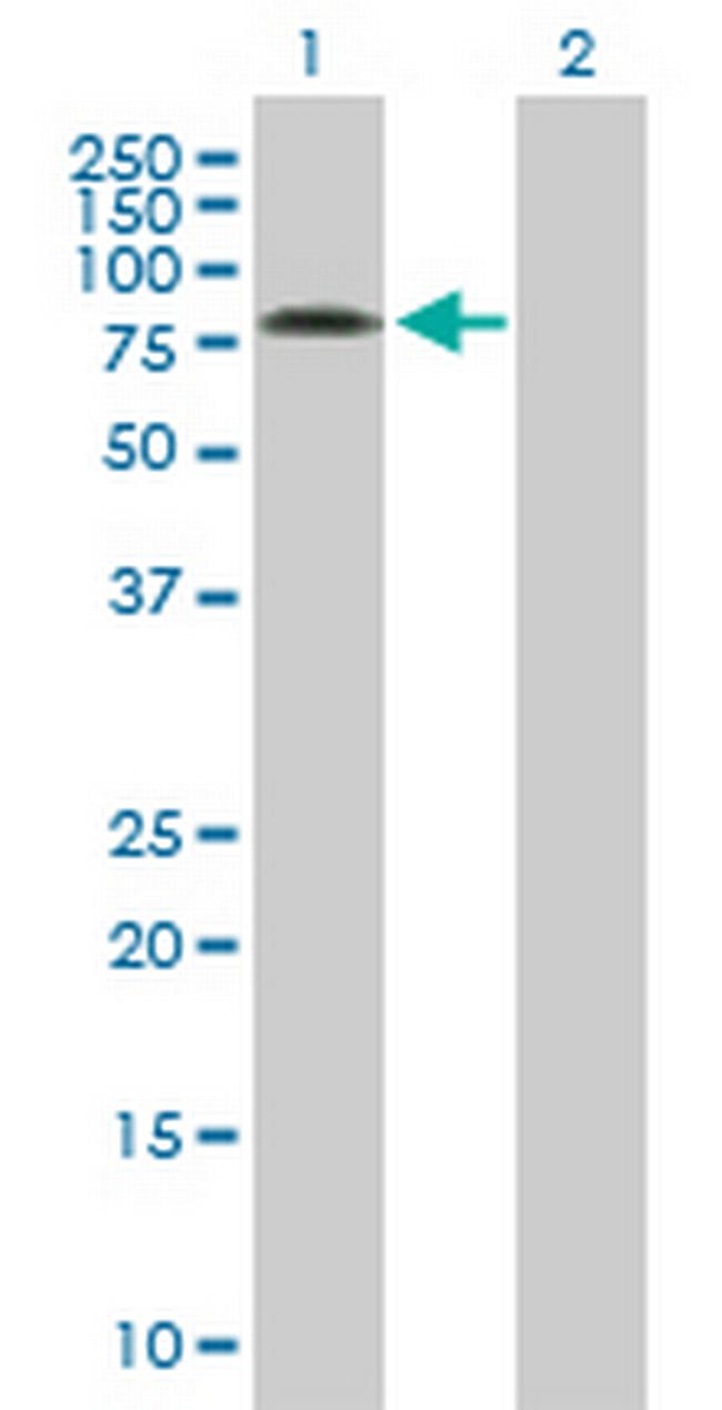 SRPR Antibody in Western Blot (WB)