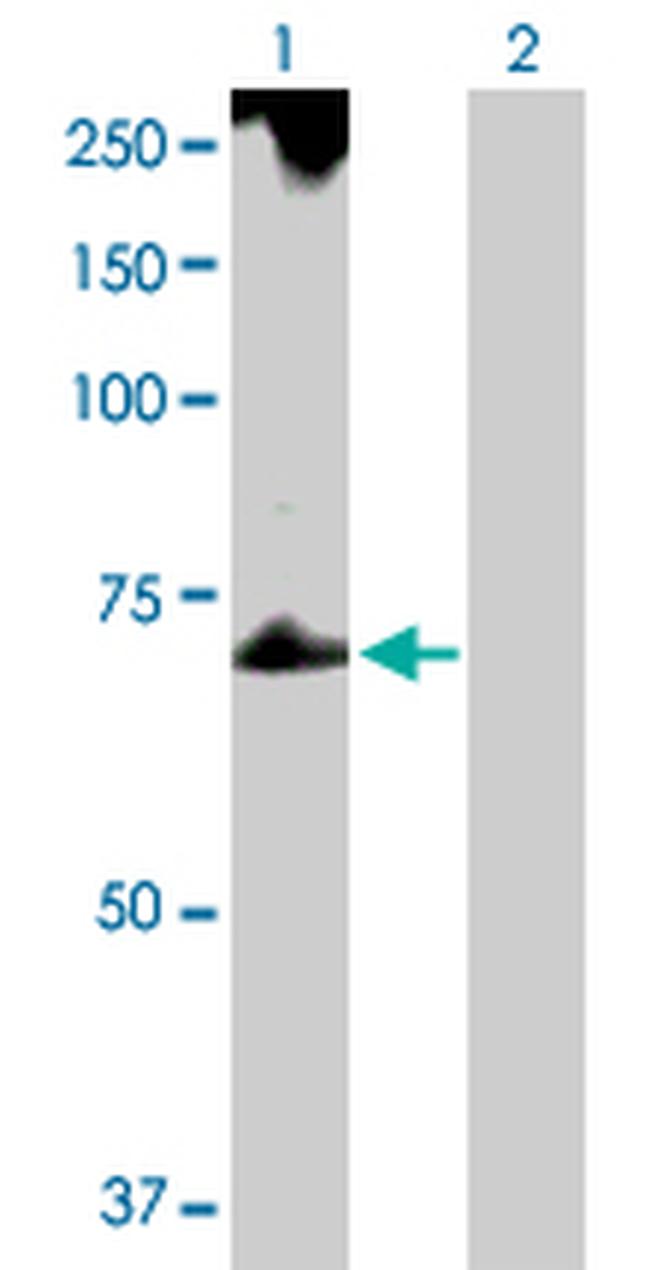 TROVE2 Antibody in Western Blot (WB)