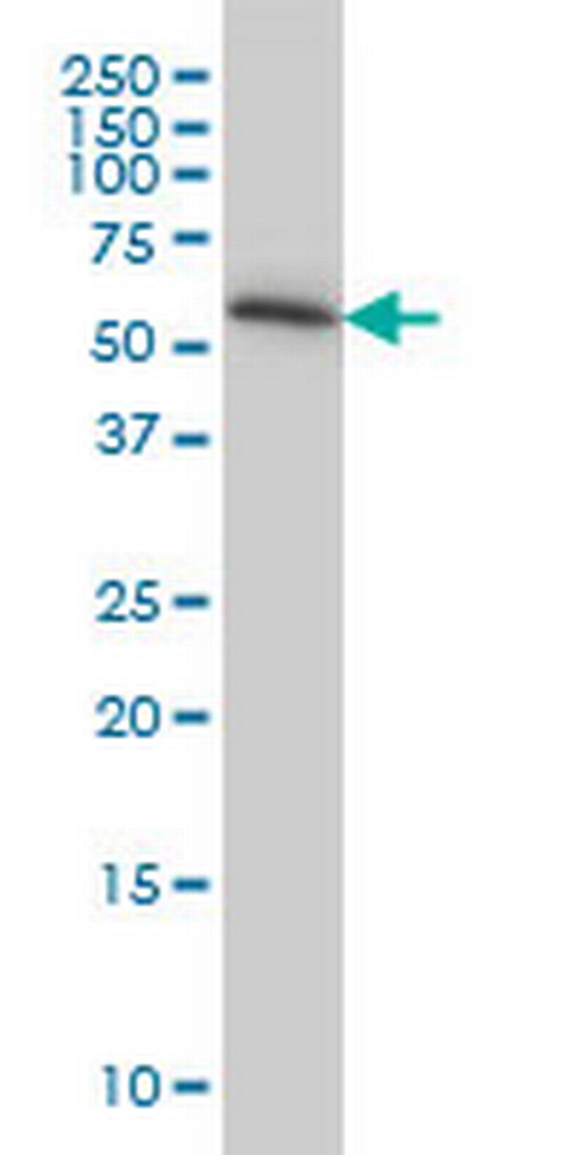 TROVE2 Antibody in Western Blot (WB)