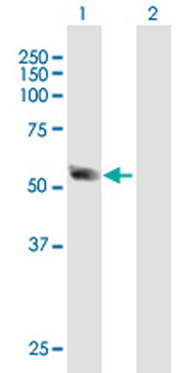 SSB Antibody in Western Blot (WB)
