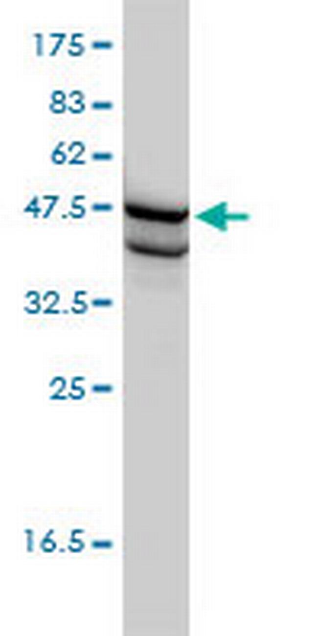 SSB Antibody in Western Blot (WB)