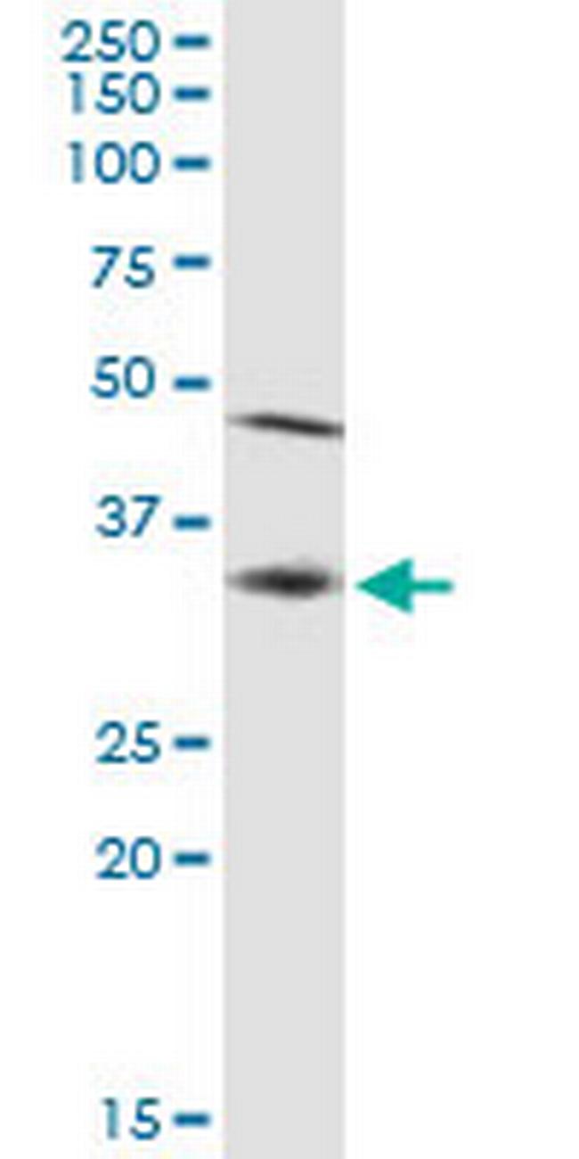 SSR1 Antibody in Western Blot (WB)