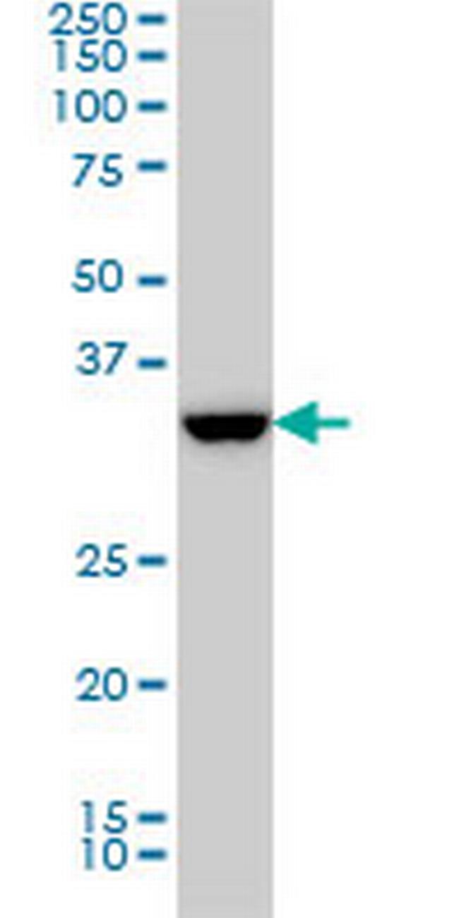 SSR1 Antibody in Western Blot (WB)
