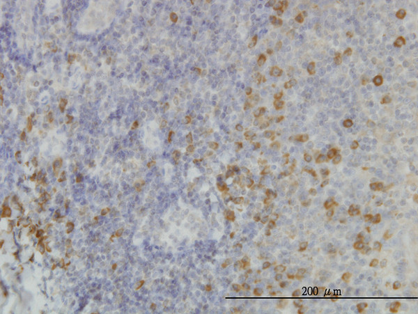 SSR1 Antibody in Immunohistochemistry (Paraffin) (IHC (P))