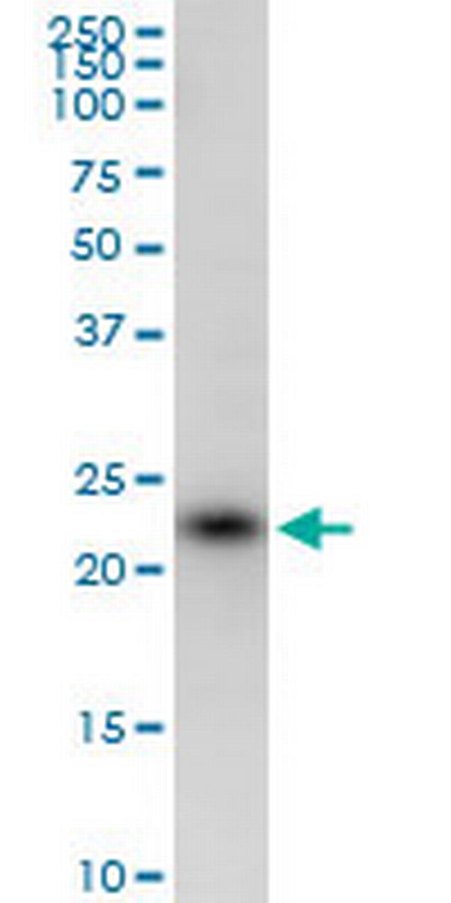 SSR2 Antibody in Western Blot (WB)