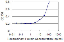 SSTR1 Antibody in ELISA (ELISA)
