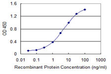 SSTR1 Antibody in ELISA (ELISA)