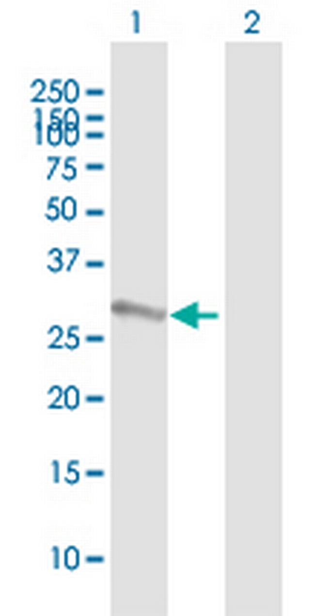 SSX2 Antibody in Western Blot (WB)