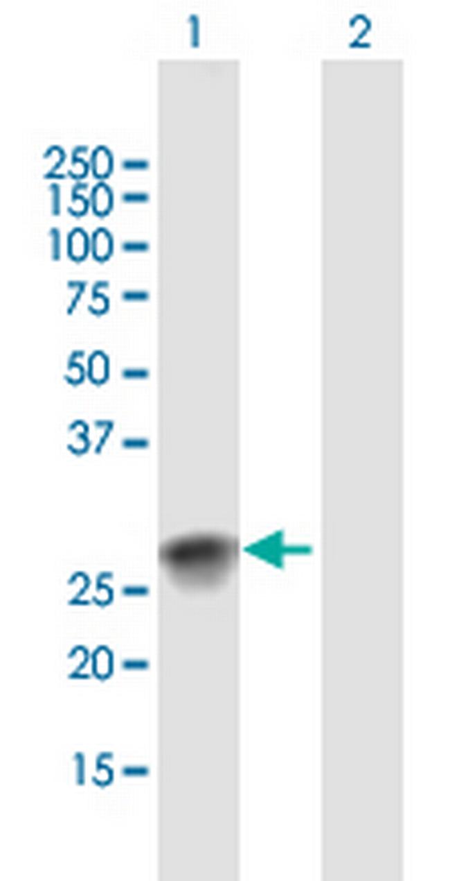SSX2 Antibody in Western Blot (WB)