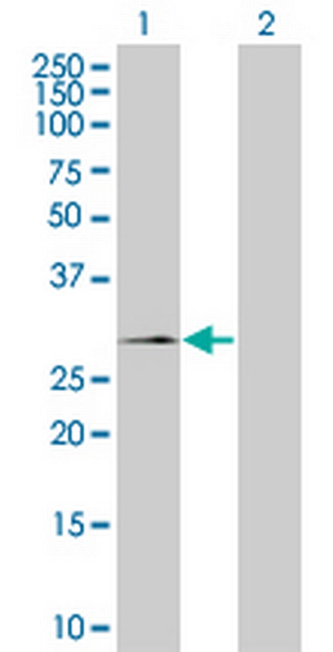 SSX2 Antibody in Western Blot (WB)