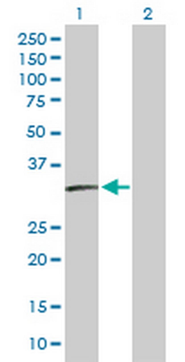 SSX2 Antibody in Western Blot (WB)