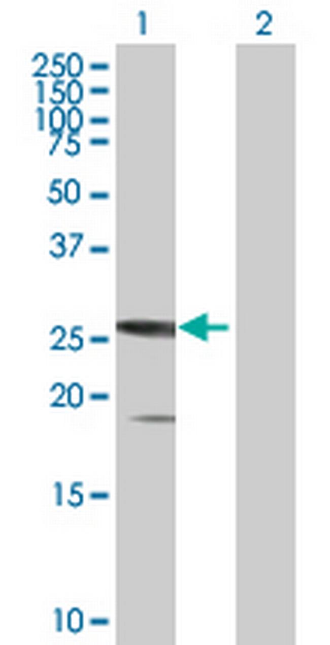 SSX5 Antibody in Western Blot (WB)