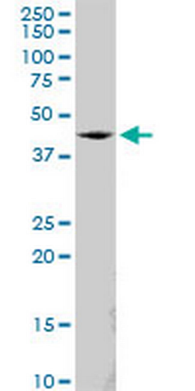 SS18 Antibody in Western Blot (WB)