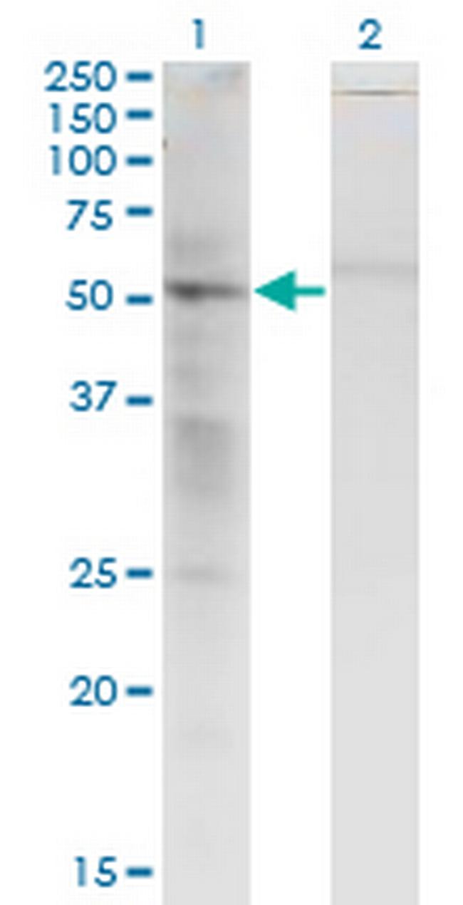 SS18 Antibody in Western Blot (WB)