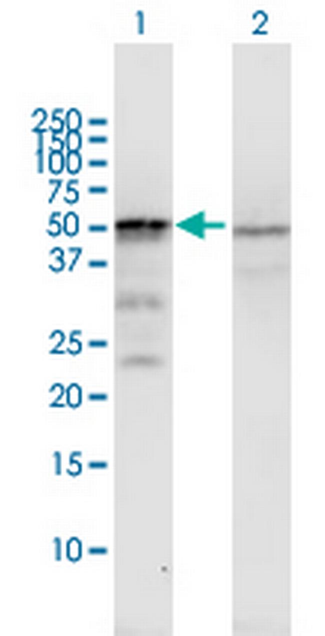 ST13 Antibody in Western Blot (WB)