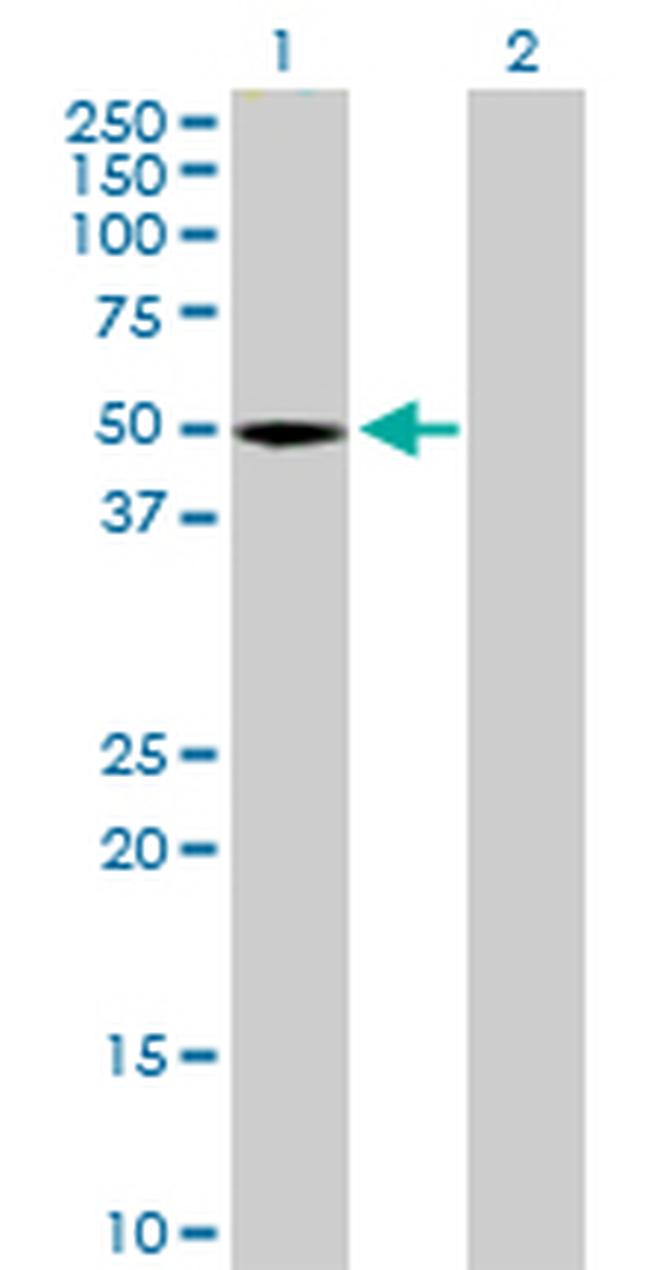 STAC Antibody in Western Blot (WB)