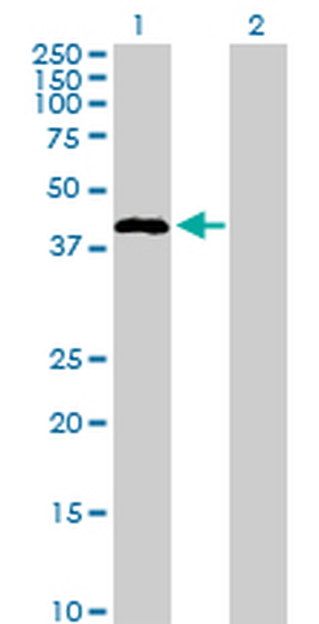 STAC Antibody in Western Blot (WB)