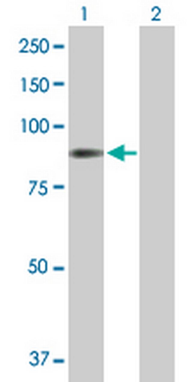 STIM1 Antibody in Western Blot (WB)