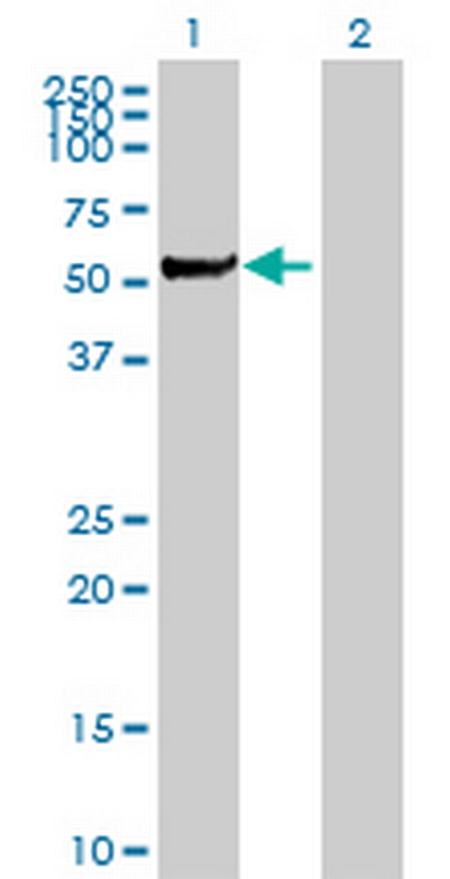 STK3 Antibody in Western Blot (WB)