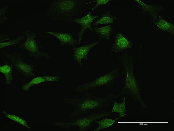 STK3 Antibody in Immunocytochemistry (ICC/IF)