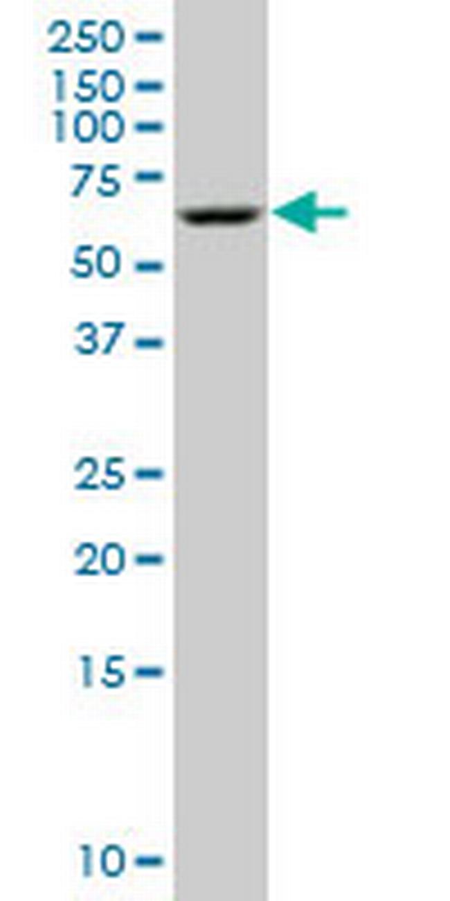 STK3 Antibody in Western Blot (WB)