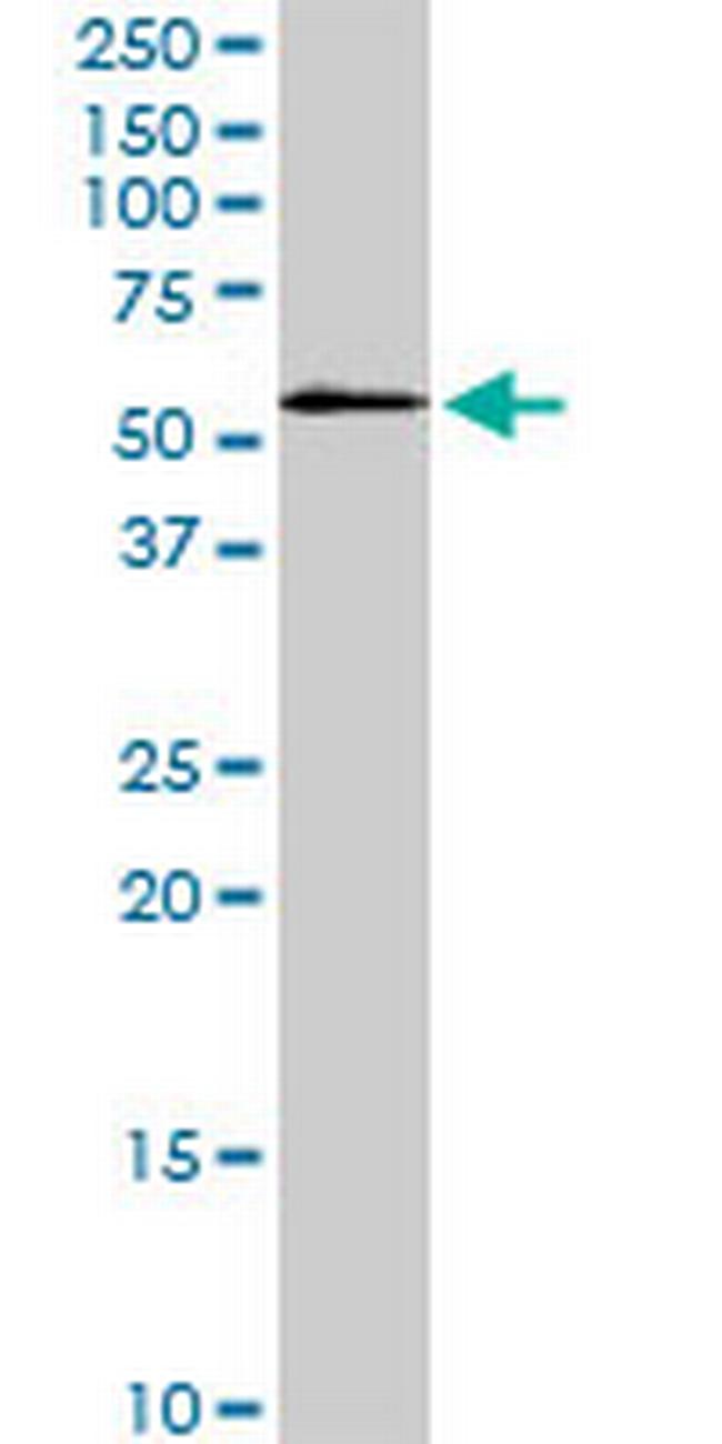 STK3 Antibody in Western Blot (WB)