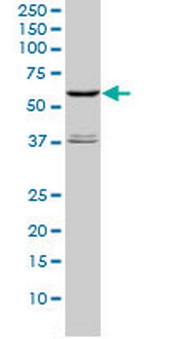 STK4 Antibody in Western Blot (WB)
