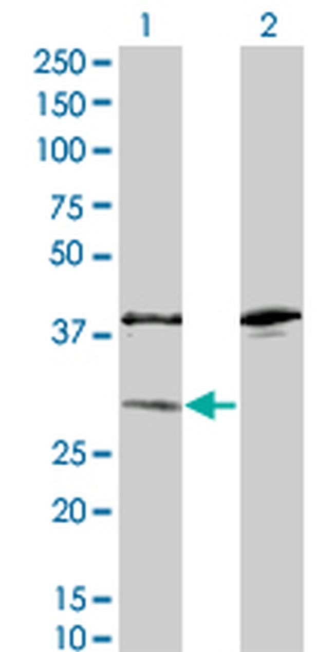 SULT1A1 Antibody in Western Blot (WB)